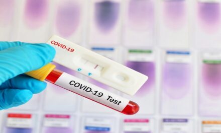 Δελτίο Τύπου Ο.Κ.Π.Α.Π.Α.: «Διενέργεια rapid test στην Κεντρική Υπηρεσία του Ο.Κ.Π.Α.Π.Α.»