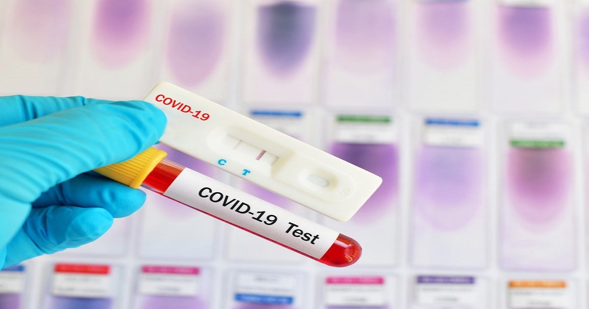 Δελτίο Τύπου Ο.Κ.Π.Α.Π.Α.: «Διενέργεια rapid test στην Κεντρική Υπηρεσία του Ο.Κ.Π.Α.Π.Α.»